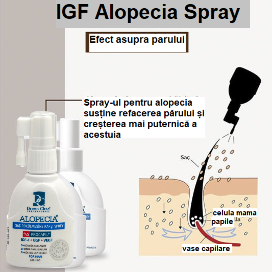 spray-pentru-cresterea-parului-la-barbati